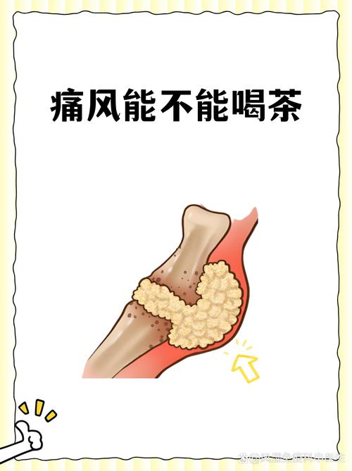 痛风喝绿茶能降尿酸吗