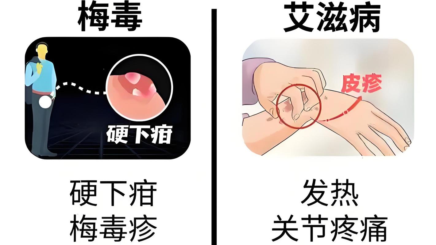 带着安全套会会感染吗