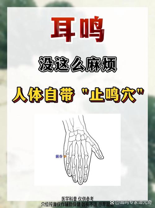 针灸治疗耳鸣的穴位