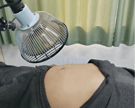 脾胃湿热针灸能好吗