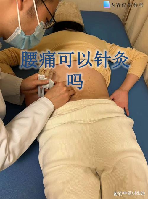 腰肌劳损可以针灸么