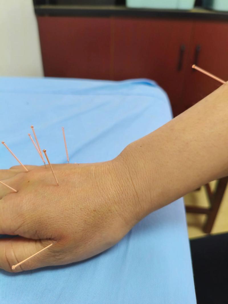 大腿内侧疼怎么针灸