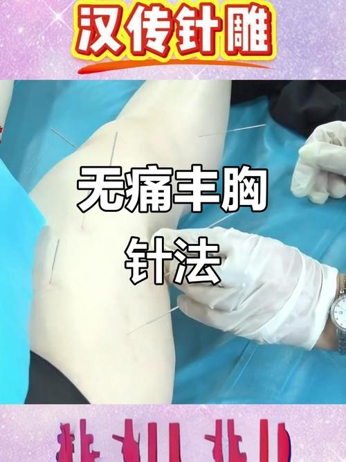 深圳做过针灸丰胸的