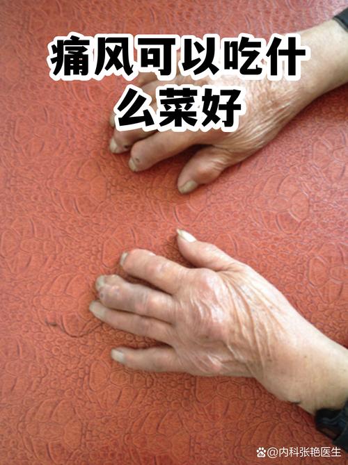 脚痛风吃什么食物最好