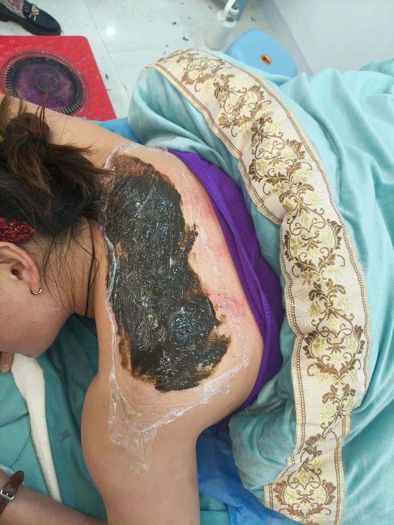 针灸减肥后头晕恶心