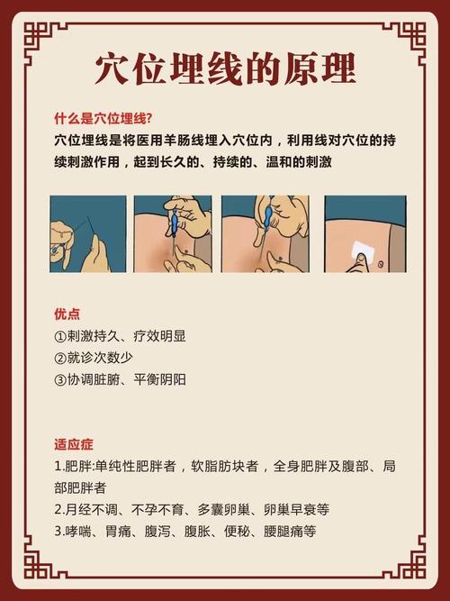 针灸减肥要注意哪些