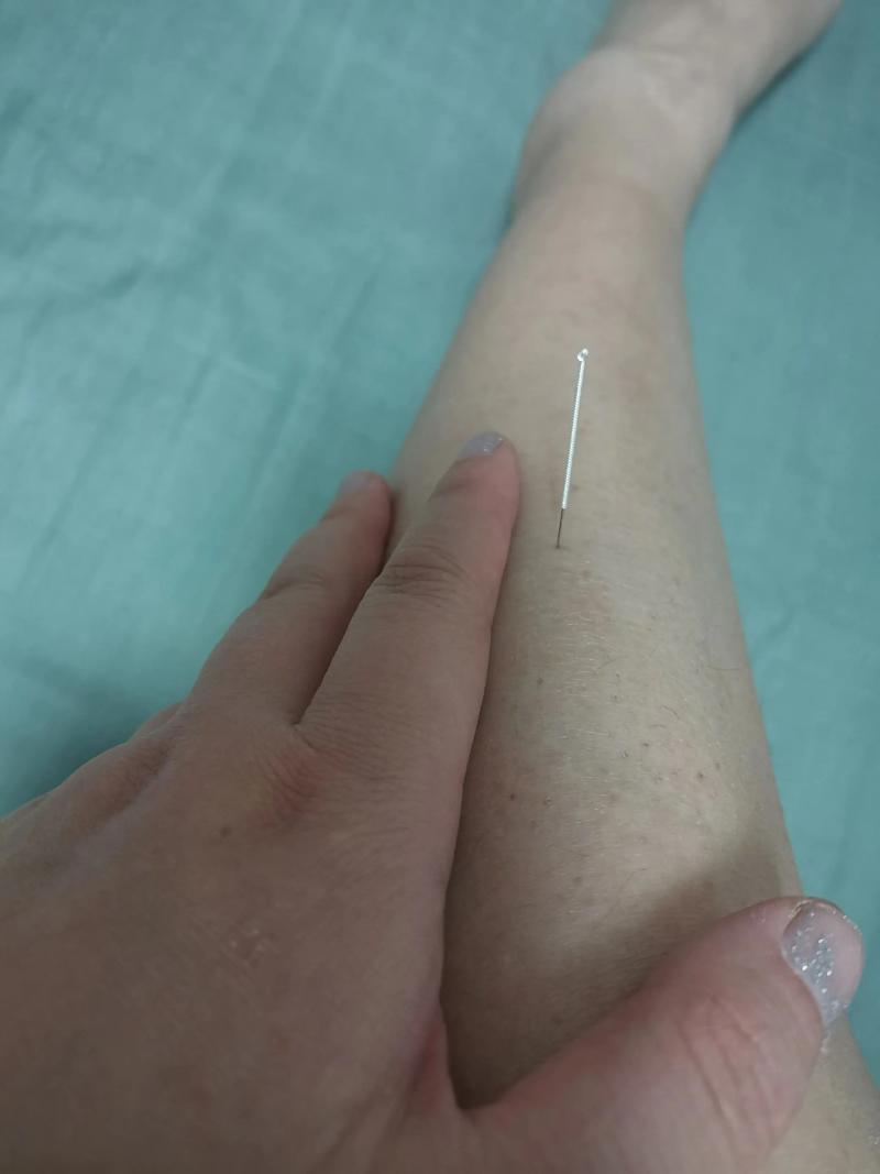 足跟痛针灸治疗图片