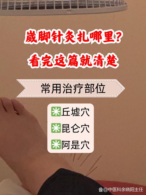 脚踝旧伤可以针灸吗