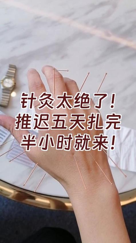 月经推迟的针灸治疗