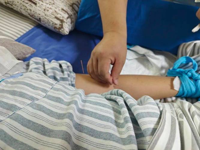 针灸治疗脑瘫的效果