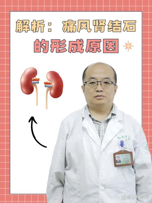 肾结石和痛风有关系吗