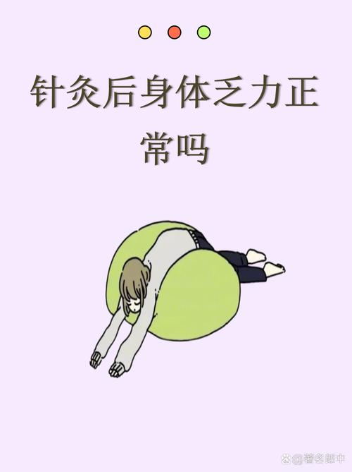 针灸会使肌肉僵硬么