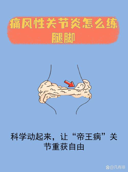 痛风发作时可以运动吗