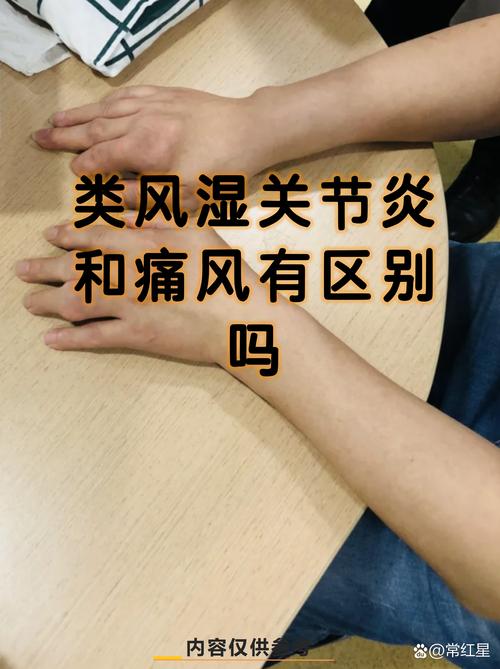 类风湿性关节炎与痛风