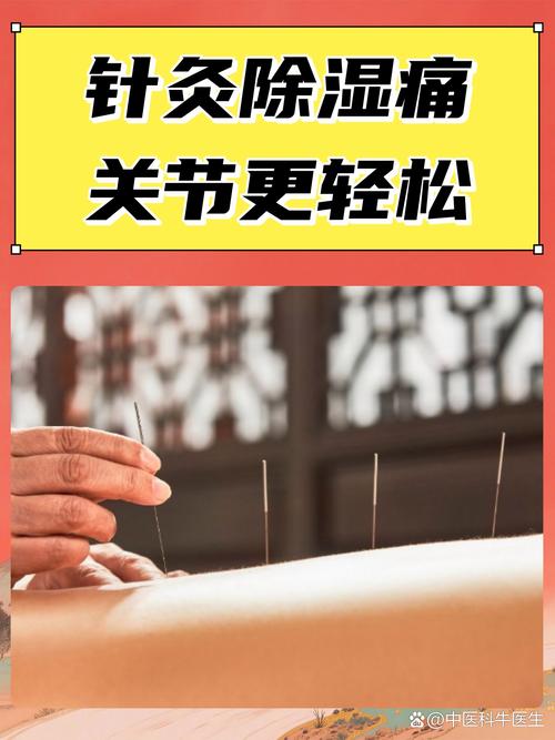 针灸治疗对身体好吗