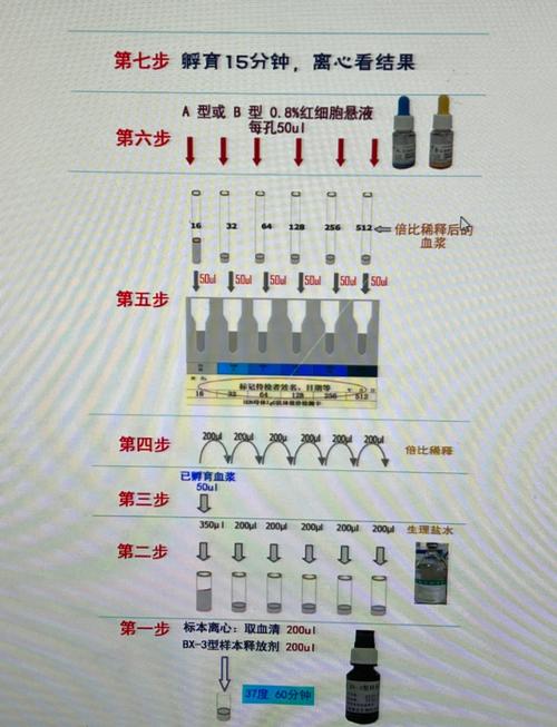 双胎输血过几周算安全