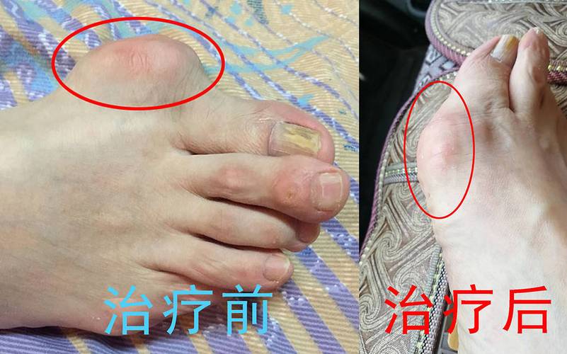 深圳痛风医院排名第一