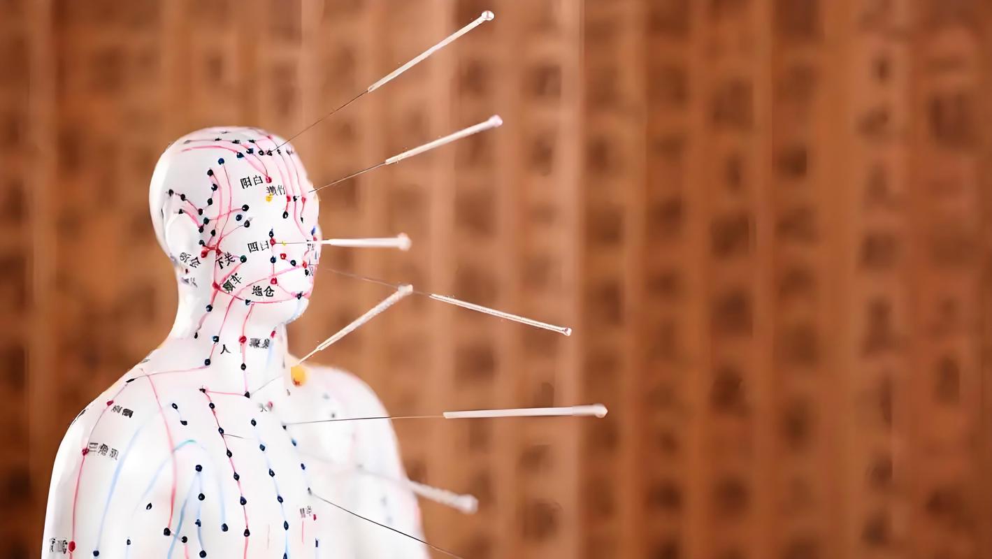 武汉哪个医院针灸好