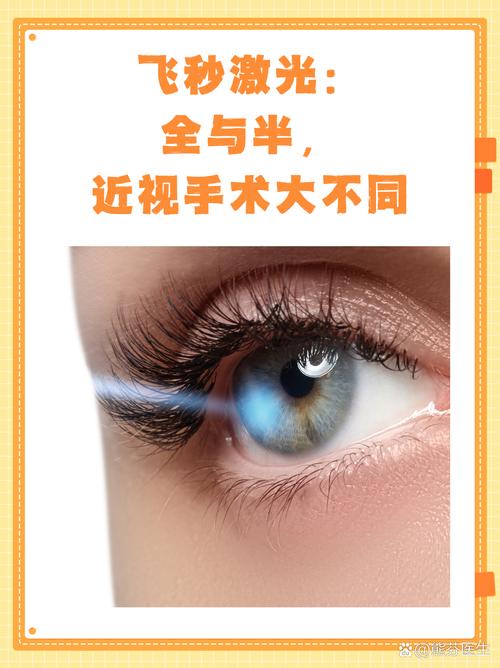 眼睛做激光手术安全吗