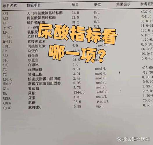 痛风的尿酸指标是多少