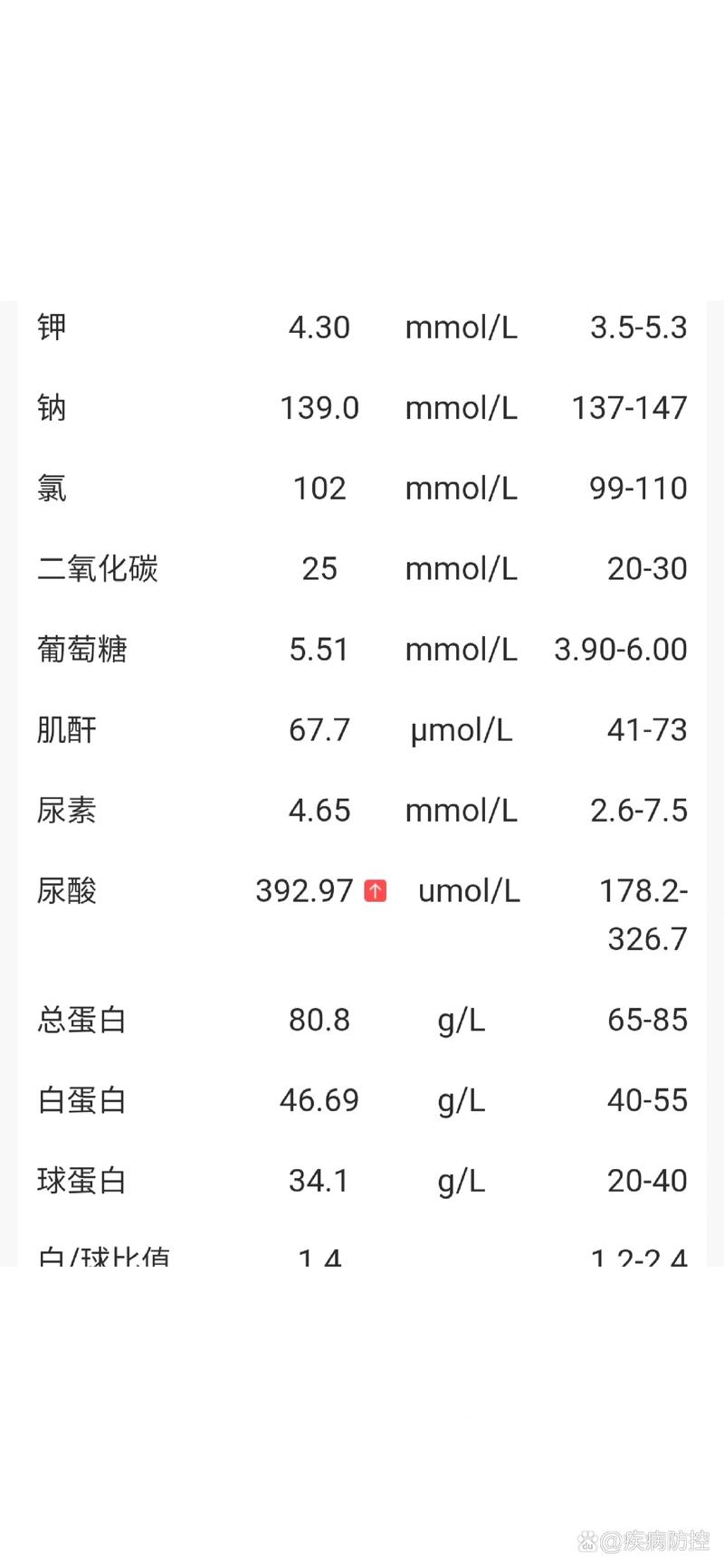 痛风多少为正常尿酸值