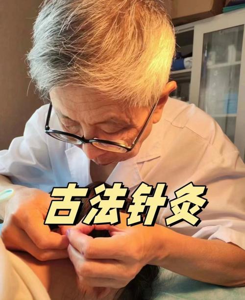 中医针灸有哪些大师