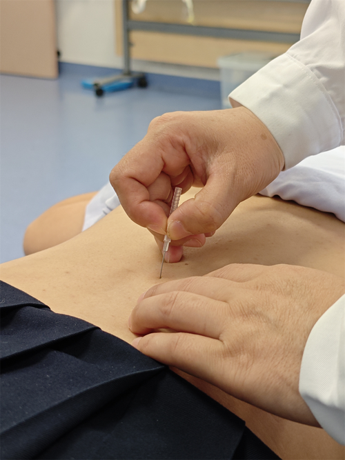 妇科针灸和妇科理疗