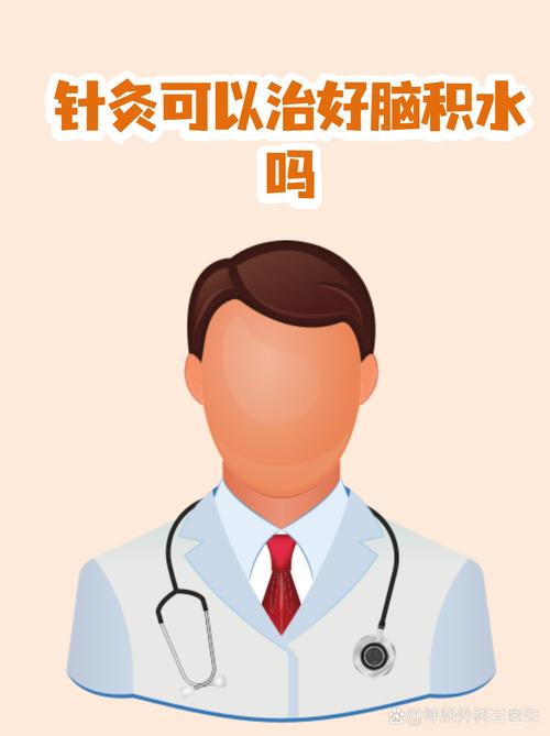 脑积水针灸治疗方法