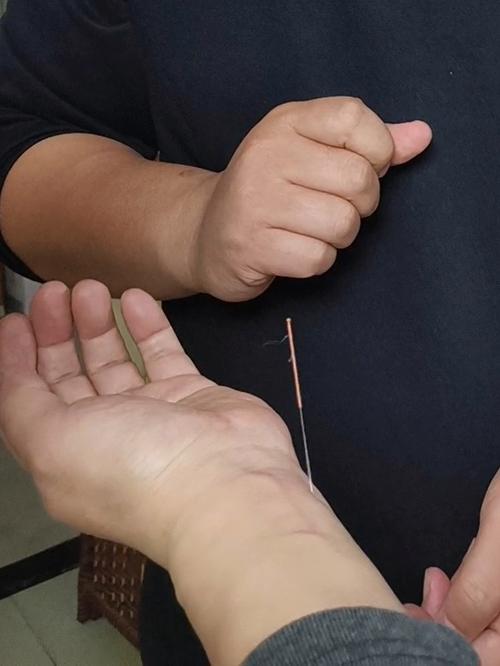 治疗失眠针灸扎哪里