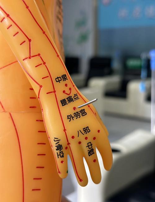 治疗失眠针灸扎哪里