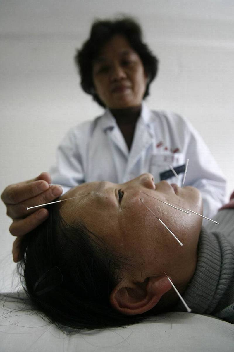 面瘫针灸期间感冒了