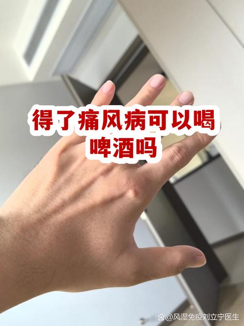 痛风的人可以喝红酒吗