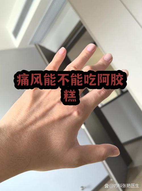 痛风为什么不能吃糯米
