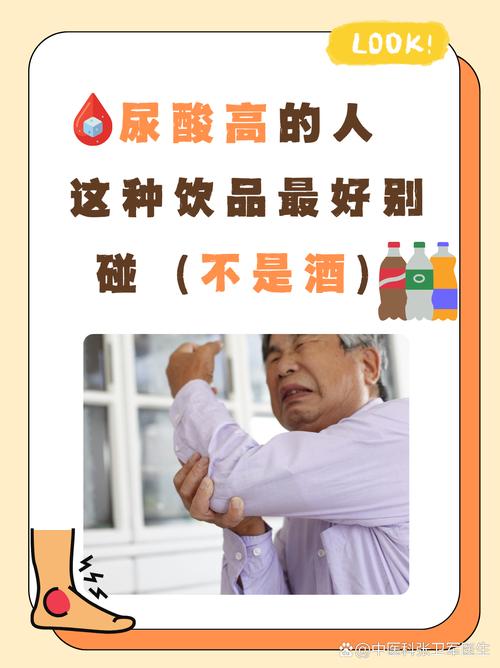 碳酸饮料会引起痛风吗