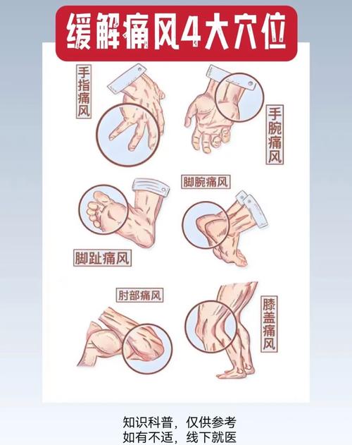 改善痛风的方法有哪些