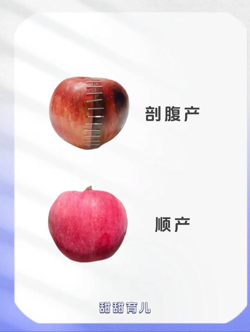 抛妇产和顺产哪个安全