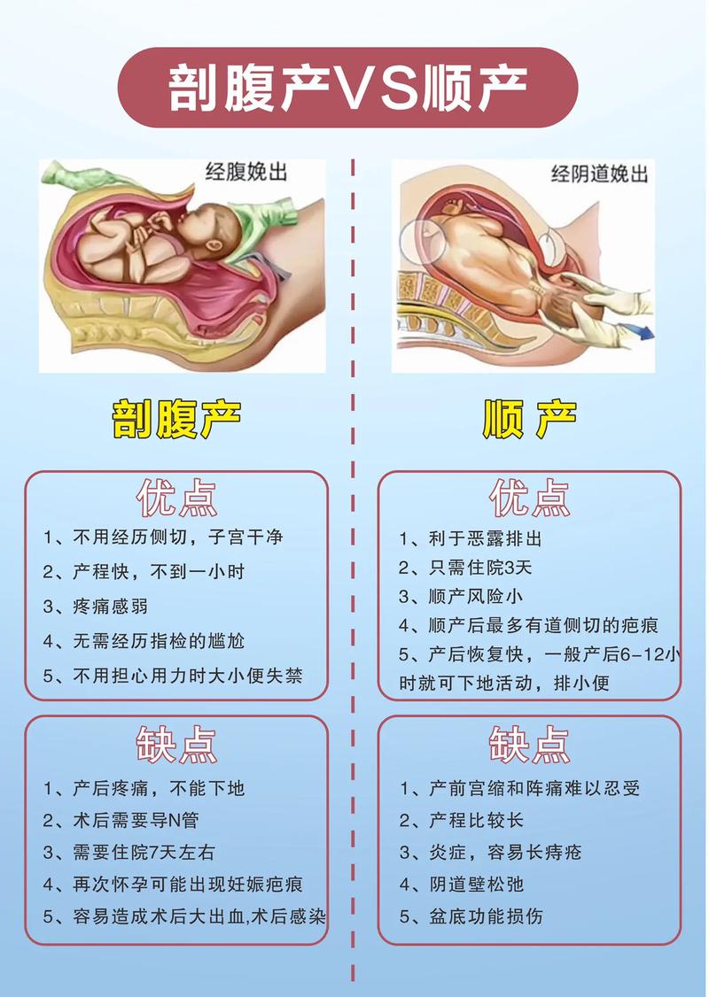 抛妇产和顺产哪个安全