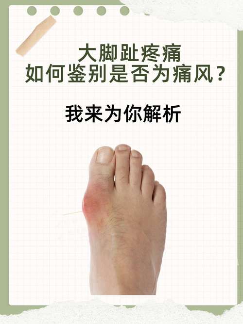 痛风引起的脚痛怎么办