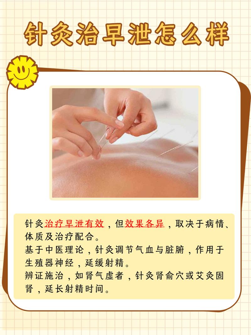 男人针灸有什么好处