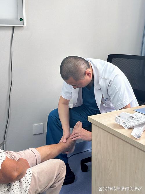 静脉曲张 中医针灸