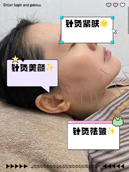 面部皮炎针灸管用吗