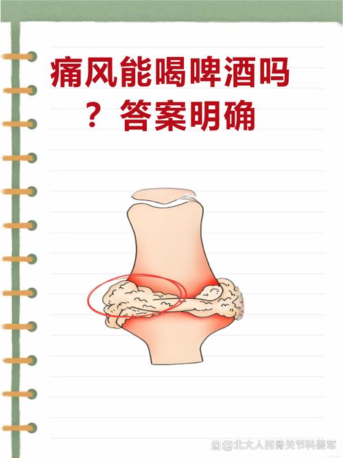痛风好了可以喝啤酒吗