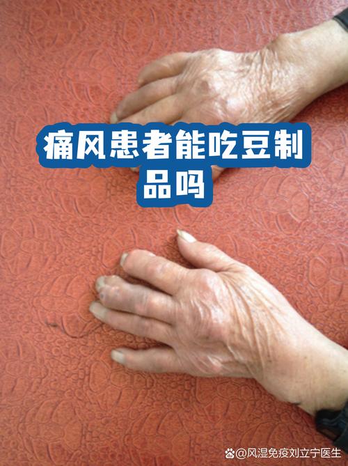 痛风病人能吃豆制品吗