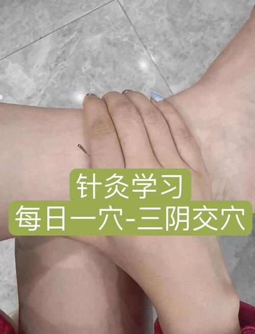 女人经期可以针灸吗