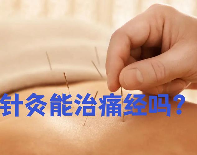 女人经期可以针灸吗