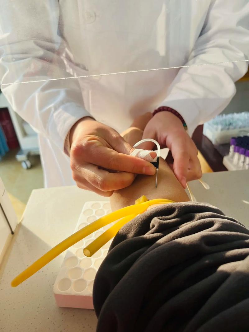 小孩尿床可以针灸吗