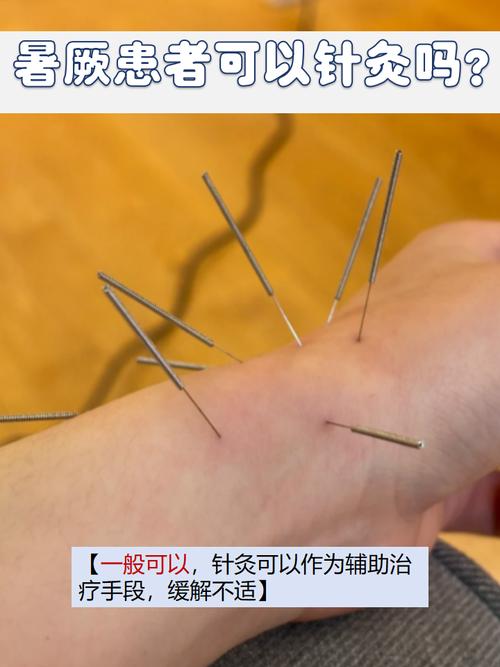 湿热针灸几次有效果