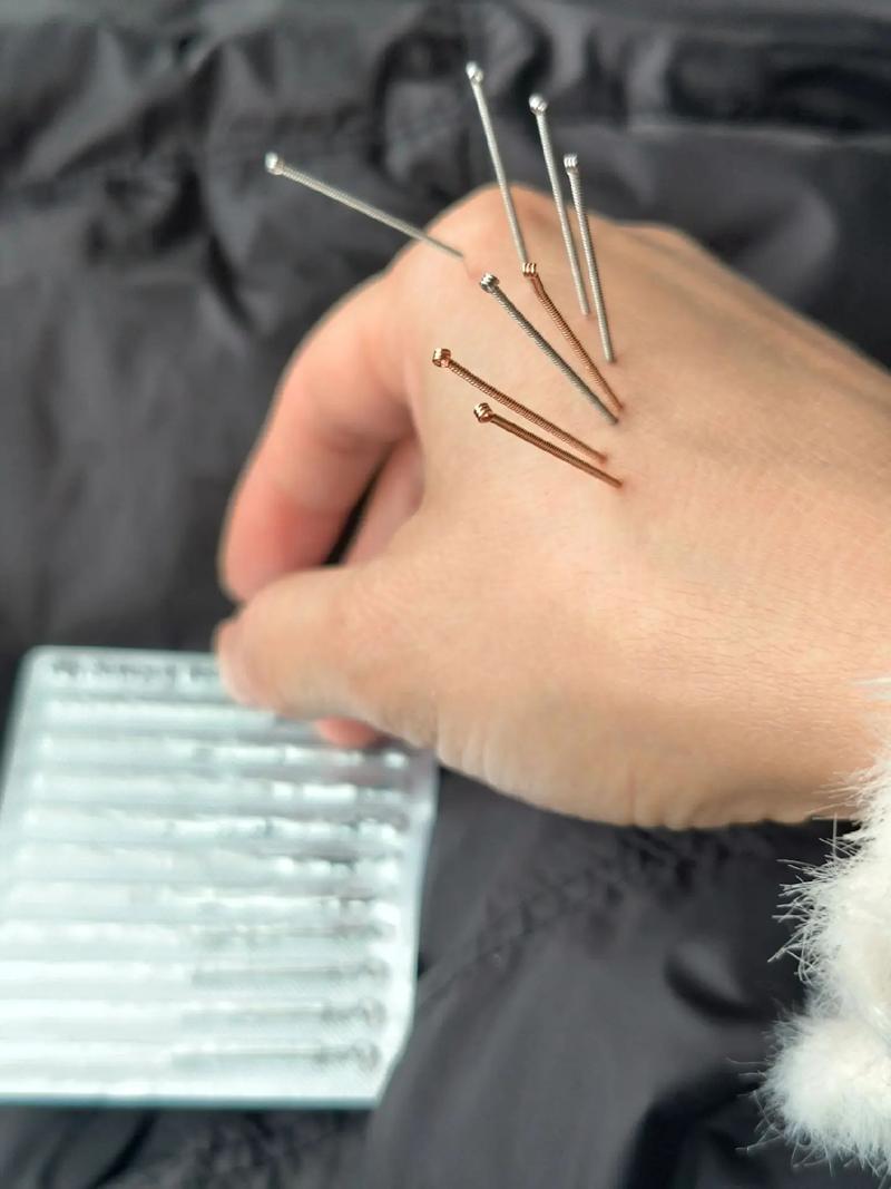 孕妇牙痛可以针灸吗