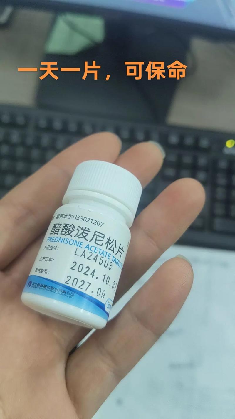 醋酸泼尼松治疗痛风吗