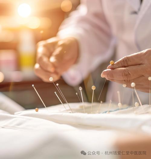 杭州中医针灸哪里好